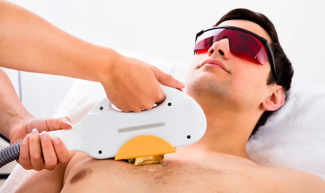 IPL Permanent Hair Removal